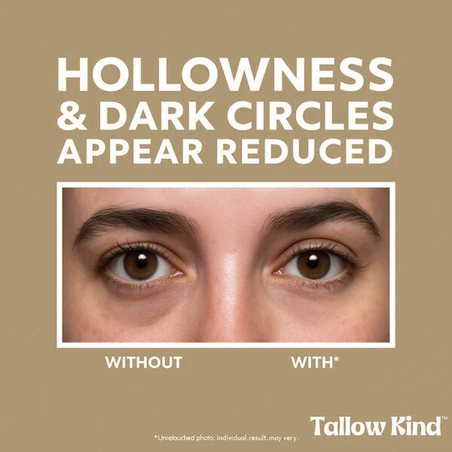 Tallow Kind™ Fill + Fix Under-Eye Cream